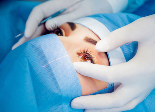 Paciente durante cirurgia de plástica ocular.